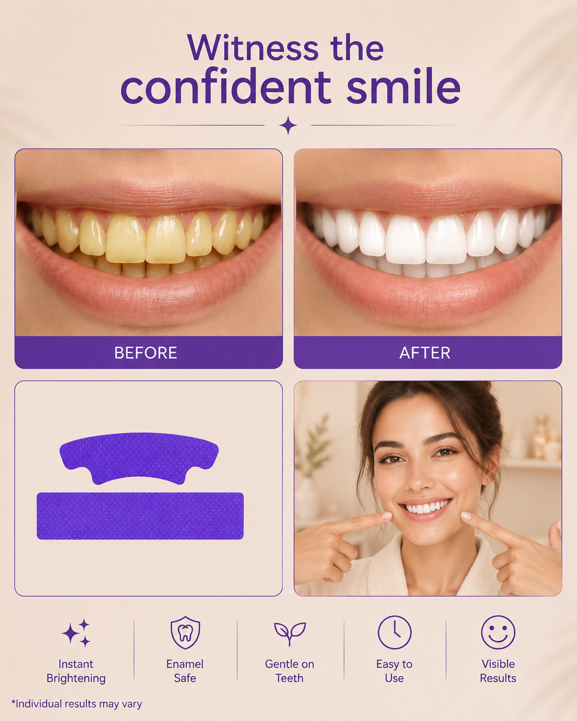 VioletGlow Whitening Strips