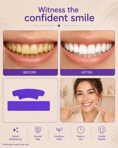 VioletGlow Whitening Strips